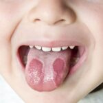 آخرین پیشرفت ها در تحقیقات و درمان سرطان زبان