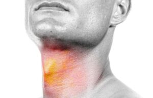 سرطان سر و گردن چه علائمی دارد؟