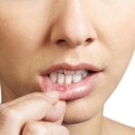 سرطان دهان در بزرگسالان جوان: خطرات، علائم و راهبردهای پیشگیری